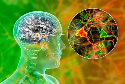 Huntington's disease