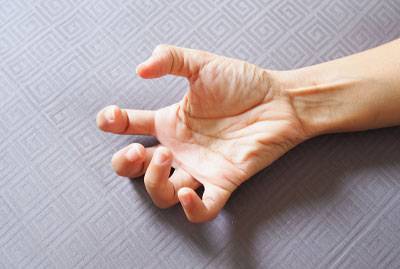 Simple Partial Seizures