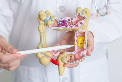 Colorectal (Colon) cancer